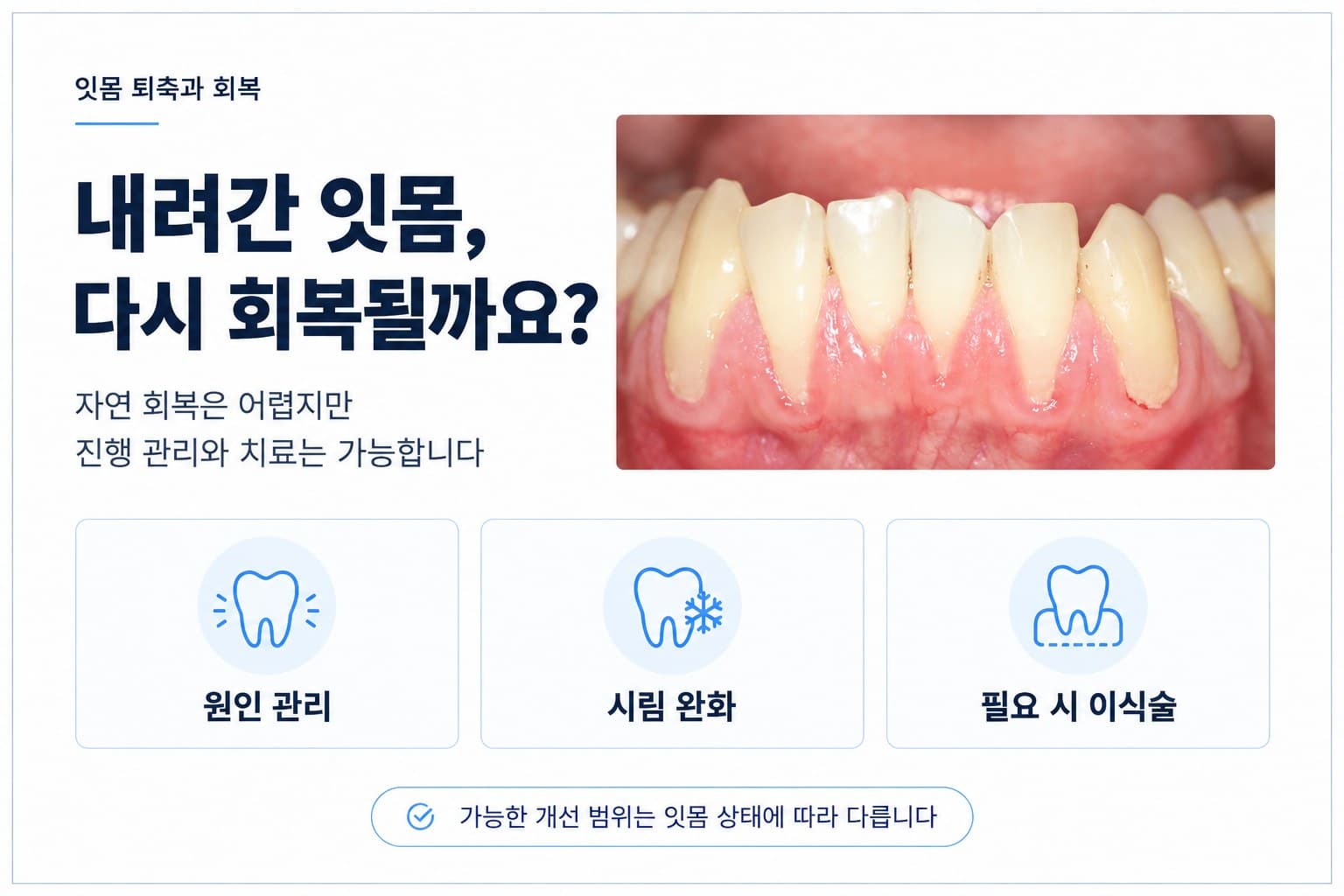 내려앉은 잇몸은 다시 올라오나요 사진.